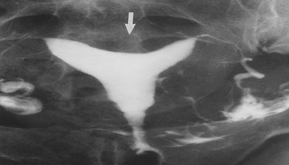 رادیولوژی رنگی (مری، معده، کلیه، مثانه، مجاری ادراری، رادیولوژی رنگی رحم و ...)