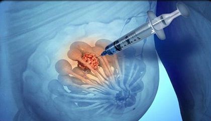 نمونه برداری از تمامی ارگان‌ها از جمله سینه ، کبد ، کلیه و ...