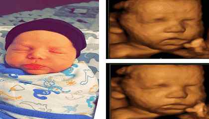 سونوگرافی سه بعدی (3D) و چهاربعدی (4D) 